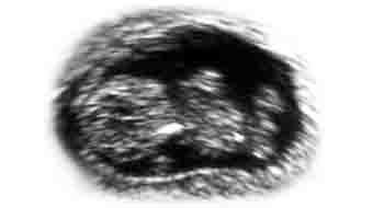 embryo_10w